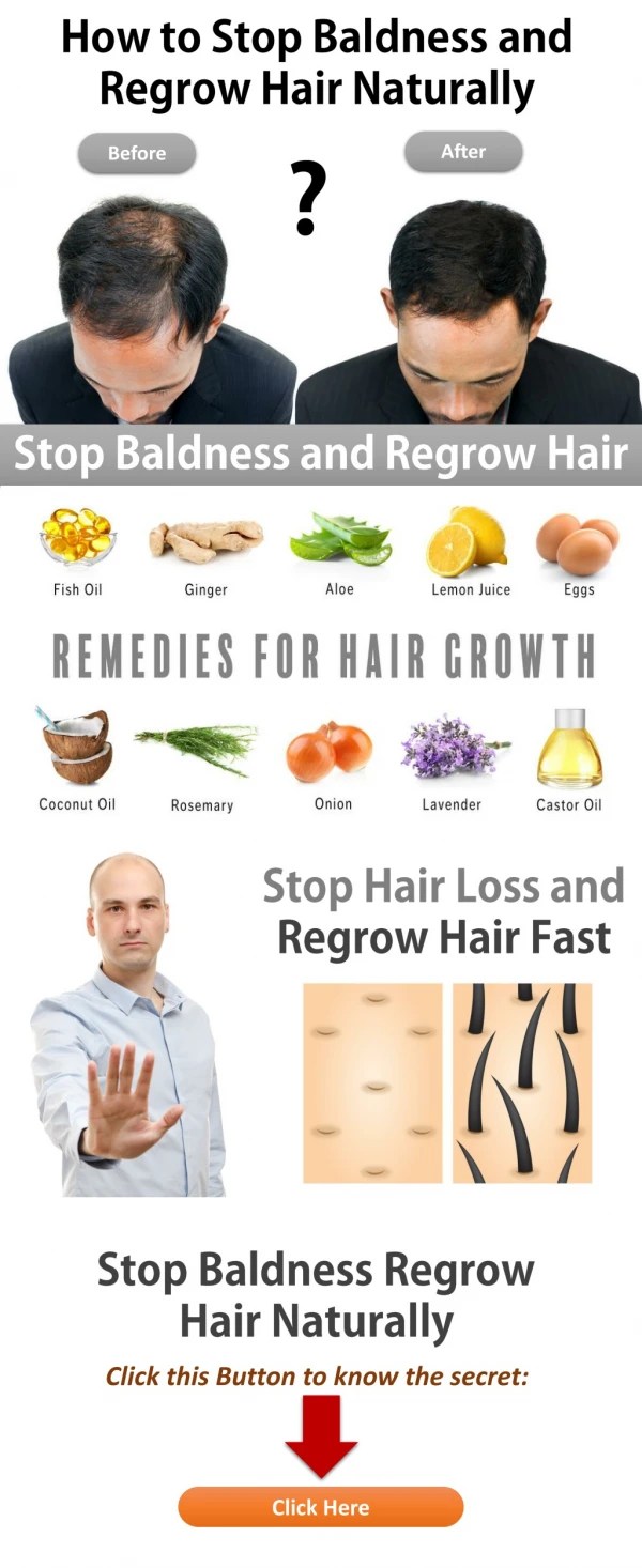 PPT How to Hair Regrowth Treatment for Women PowerPoint Presentation