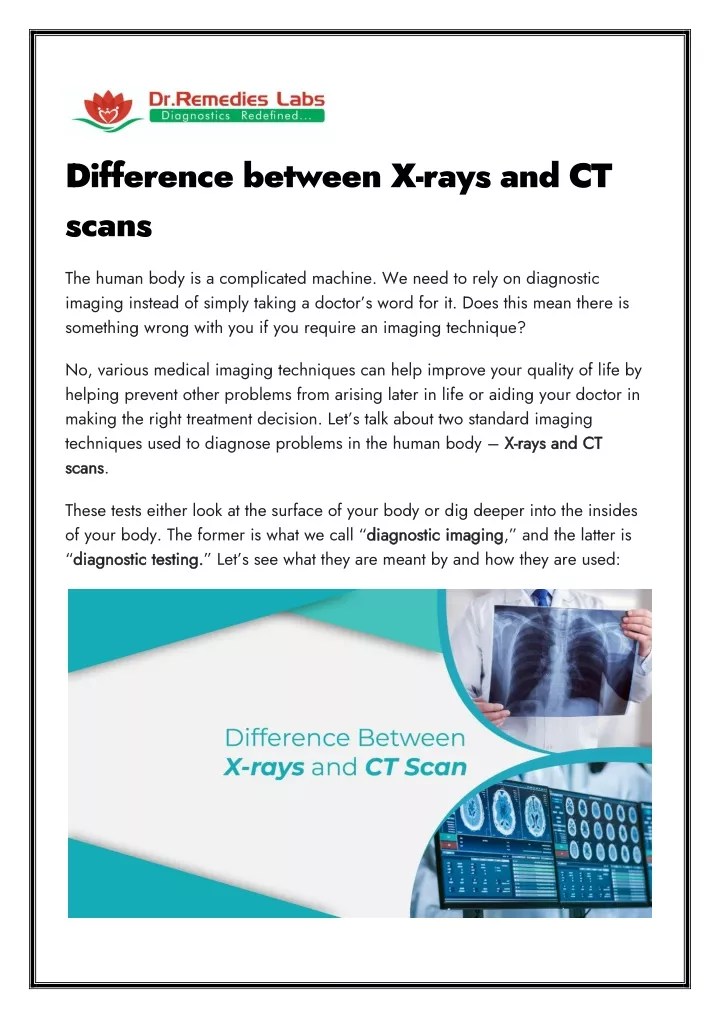 PPT Difference between Xrays and CT scans PowerPoint Presentation