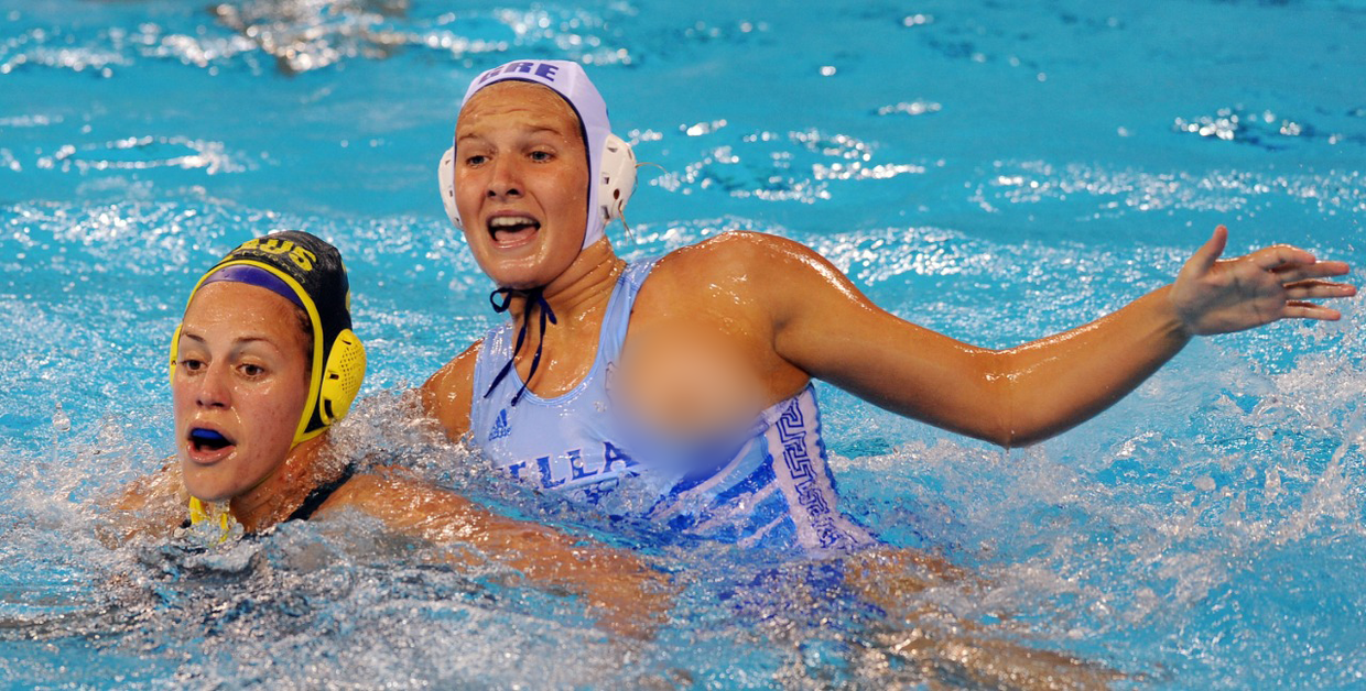Overexposed Most Embarrassing Wardrobe Malfunctions In Sport Photos