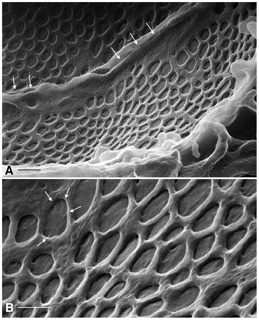 Evaluation of the Glomerular Filtration Barrier by Electron Microscopy