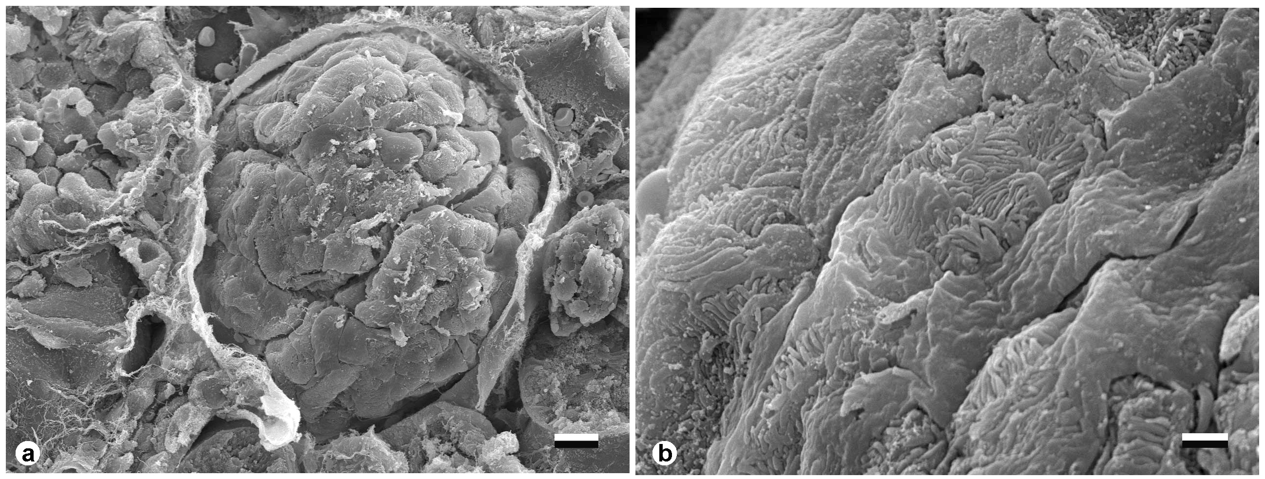Evaluation of the Glomerular Filtration Barrier by Electron Microscopy