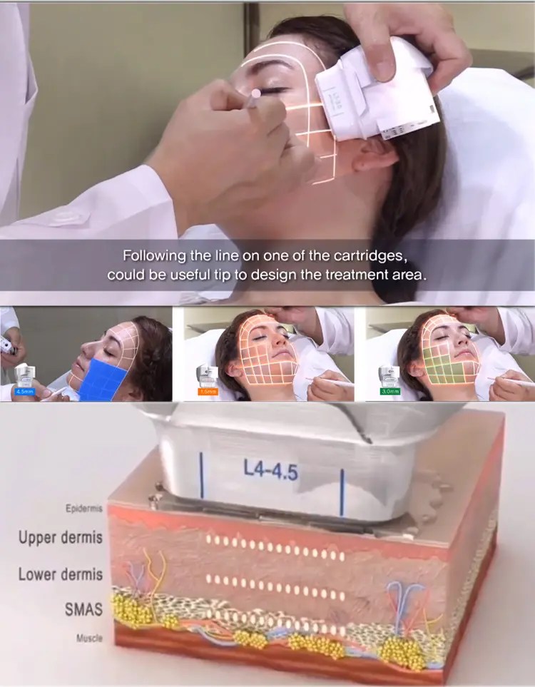 China Portable Diode Laser Hair Removal Machine Manufacturers and