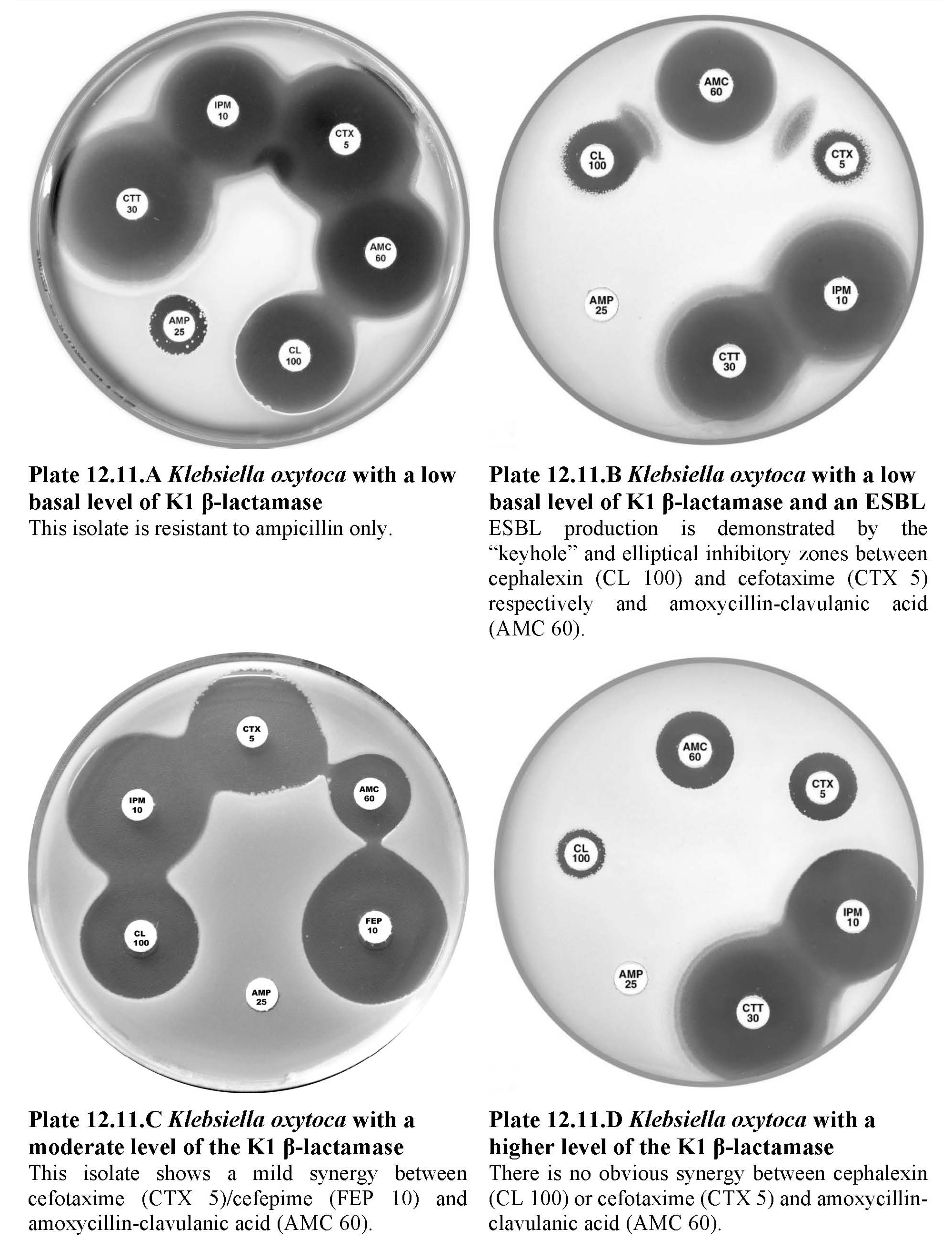 12. Plates The CDS Antibiotic Susceptibility Test