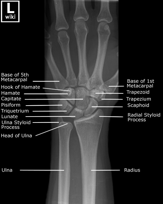 CE4RT Radiographic Positioning of the Wrist for Xray Technologists