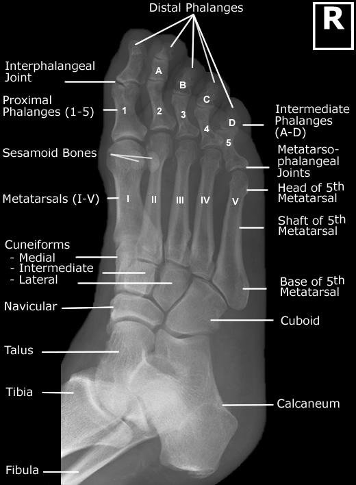 CE4RT Radiographic Positioning of the Distal Feet for Xray Techs