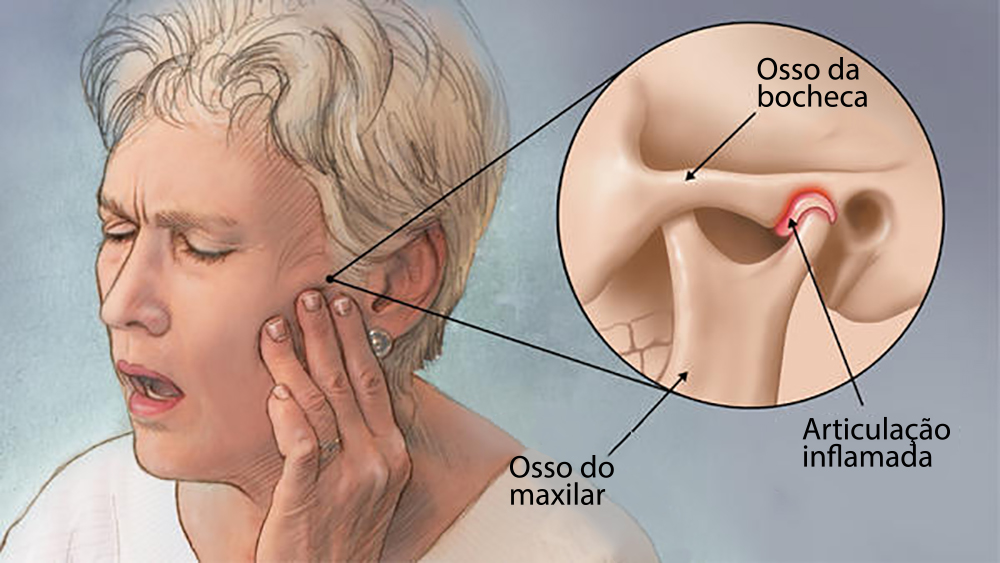 Você já ouviu falar em DTM? Saiba o que é, suas causas e dignóstico CEDAV