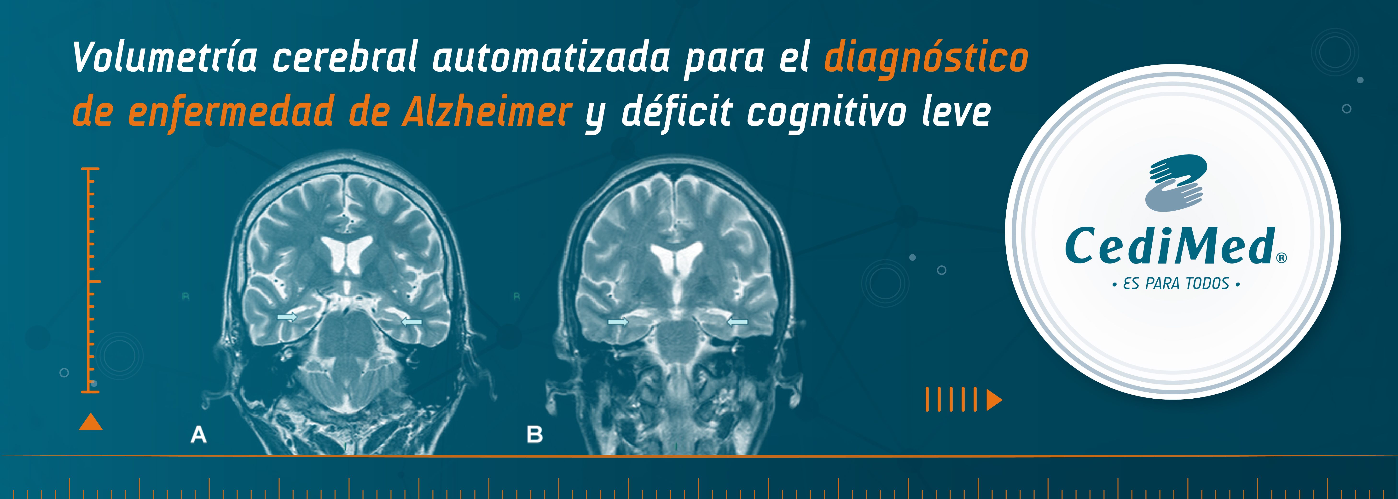 Cedimed Volumetria Cerebral Automatizada Para El Diagnostico De Enfermedad De Alzheimer Y Deficit Cognitivo Leve Cedimed