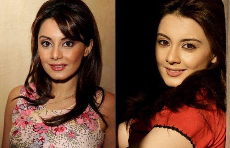 Top 10 Bollywood Actresses who did plastic surgery Celeb Glory