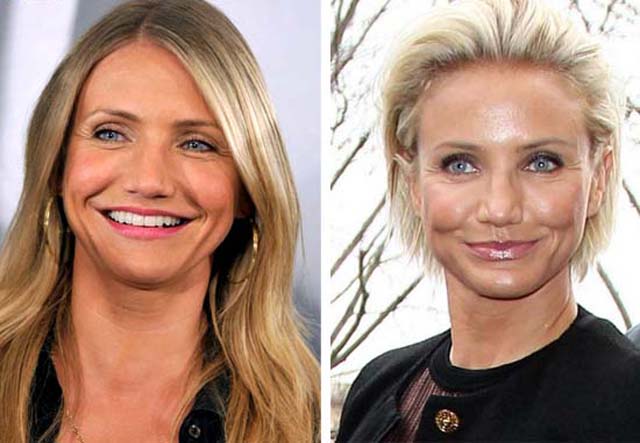 Cameron Diaz Nose Job Plastic Surgery Before and After Celebie