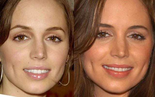 Eliza Dushku Nose Job Plastic Surgery Before and After Celebie