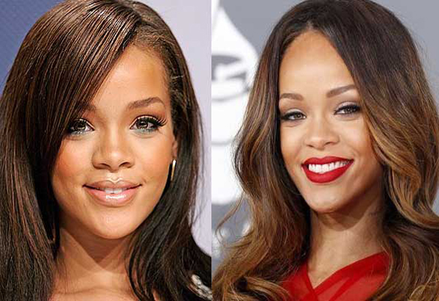 Rihanna Nose Job Plastic Surgery Before and After Celebie