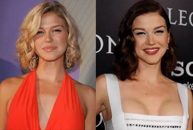 Adrianne Palicki Plastic Surgery Before and After | Celebie