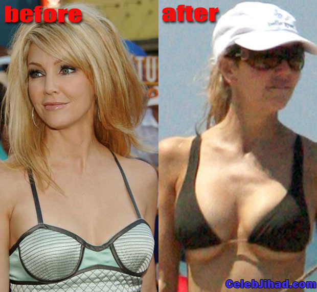 The Best Celebrity Plastic Surgery
