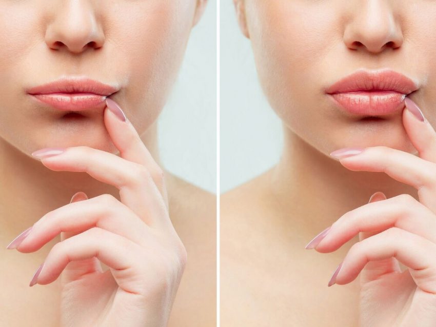 Clinica Beauty Art Aesthetics Adoptร Noile Proceduri Estetice Hollywoodiene Celebritatea