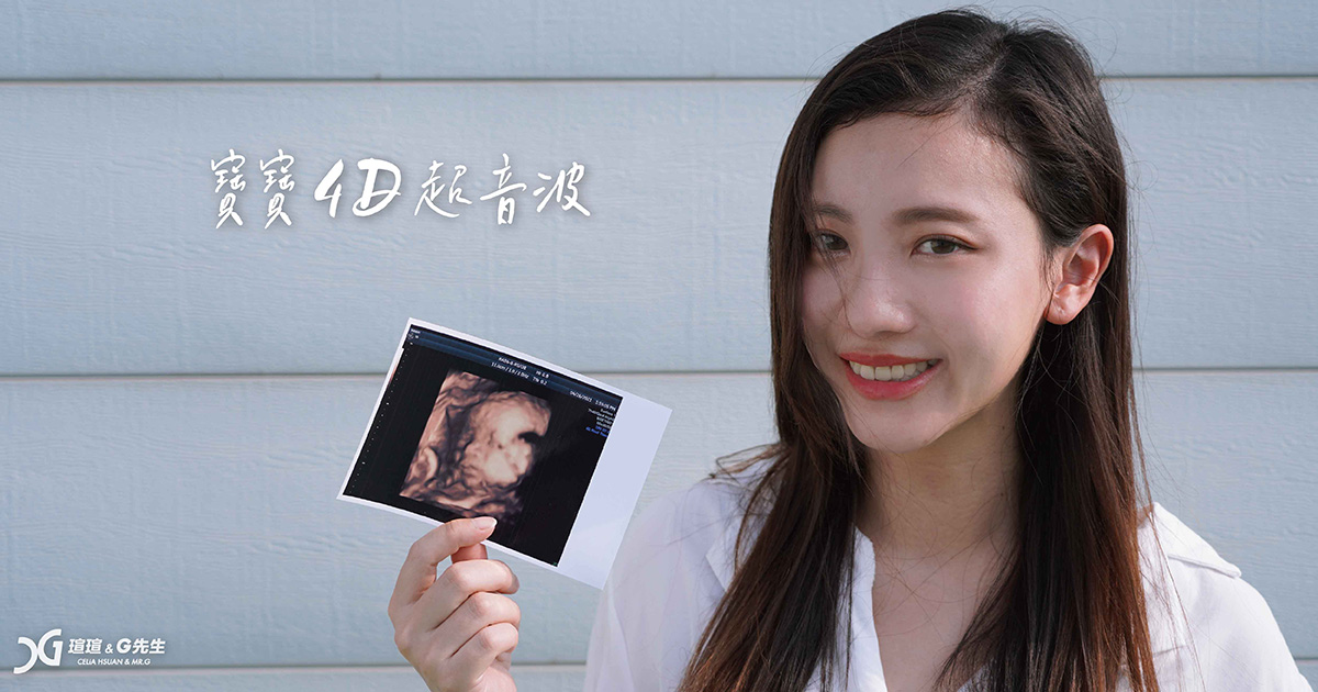 4D超音波 4D動態立體超音波 台中4D超音波推薦 3D超音波