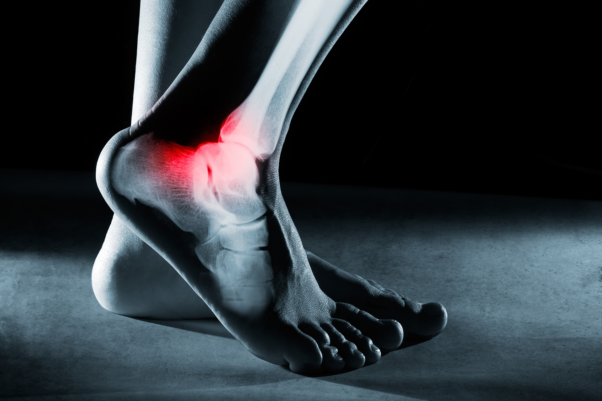 Do You Have Foot &amp; Ankle Pain? Cellaxys [Stem Cell Therapy]
