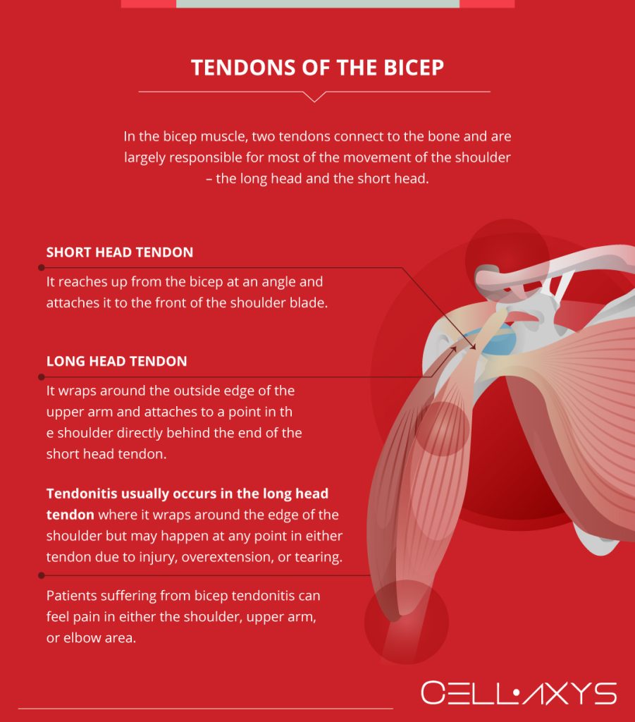Bicep Tendonitis Shoulder Pain And Treatment Cellaxys