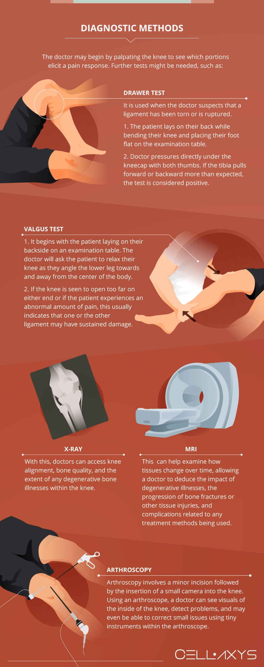 Knee Pain When Kneeling Problems, Solutions, And Recovery Through