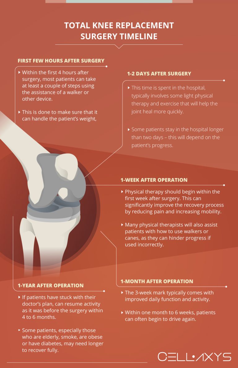 Knee Replacement Recovery Time Cellaxys