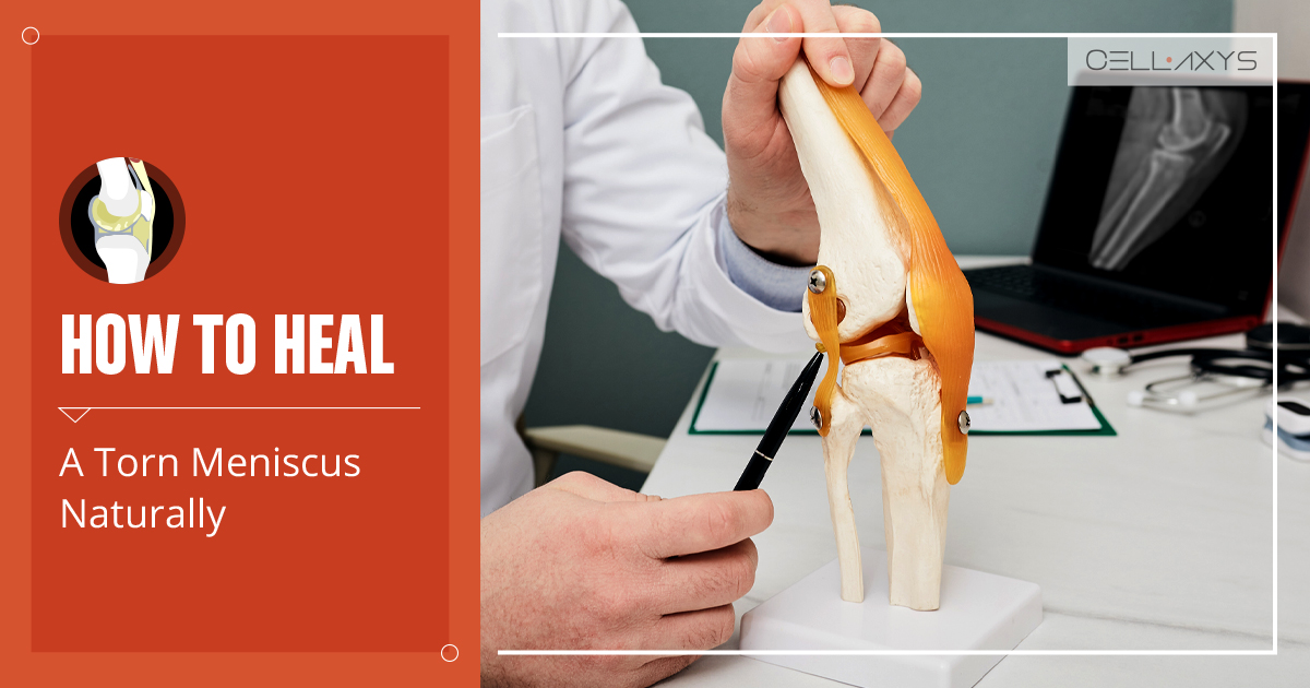 How To Heal A Torn Meniscus Naturally Cellaxys