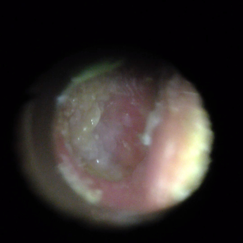 Ear Education The Scope