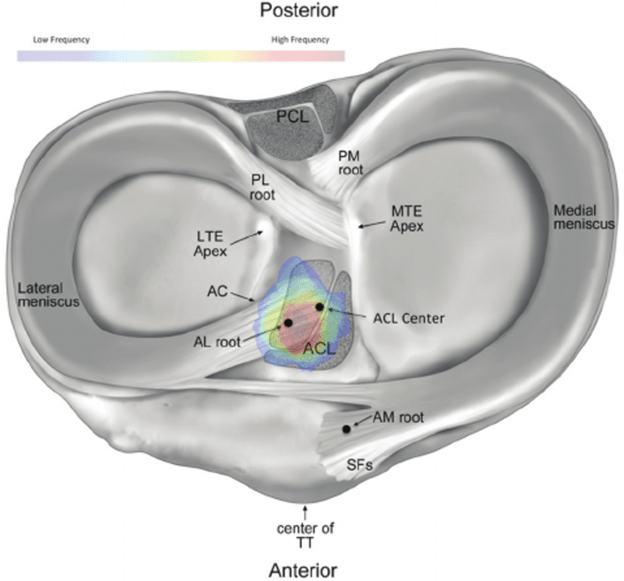 6 Meniscus Tear Types That You Need To Know About