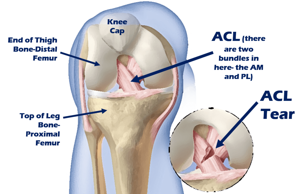 How Much Does A Acl Surgery For A Dog Cost