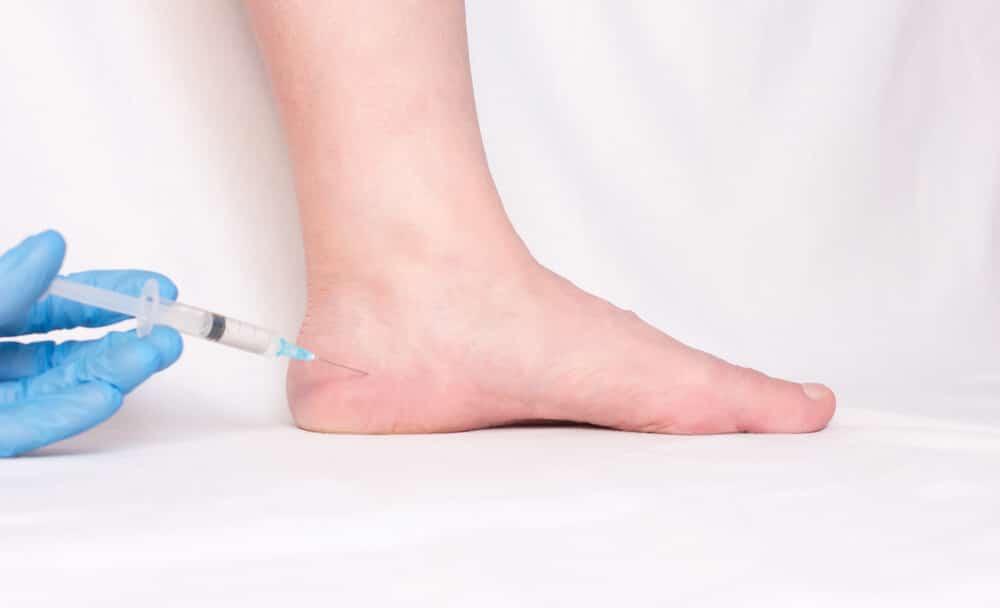 PRP for Plantar Fasciitis Treatment CentenoSchultz Clinic
