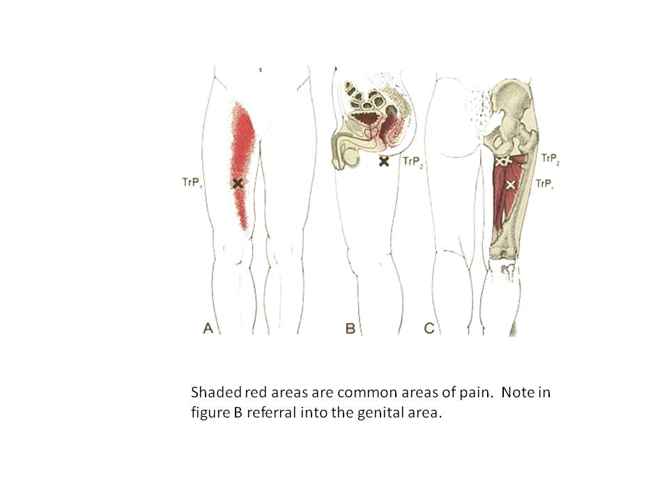 Testicle Pain Next Step Amputation CentenoSchultz Clinic