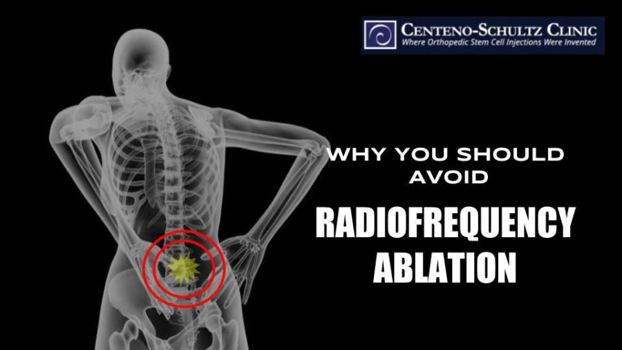 Why We Don't Perform the Radiofrequency Ablation Procedure