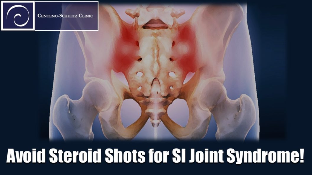 SI Joint Syndrome? Skip the Steroids Stem Cell Blog