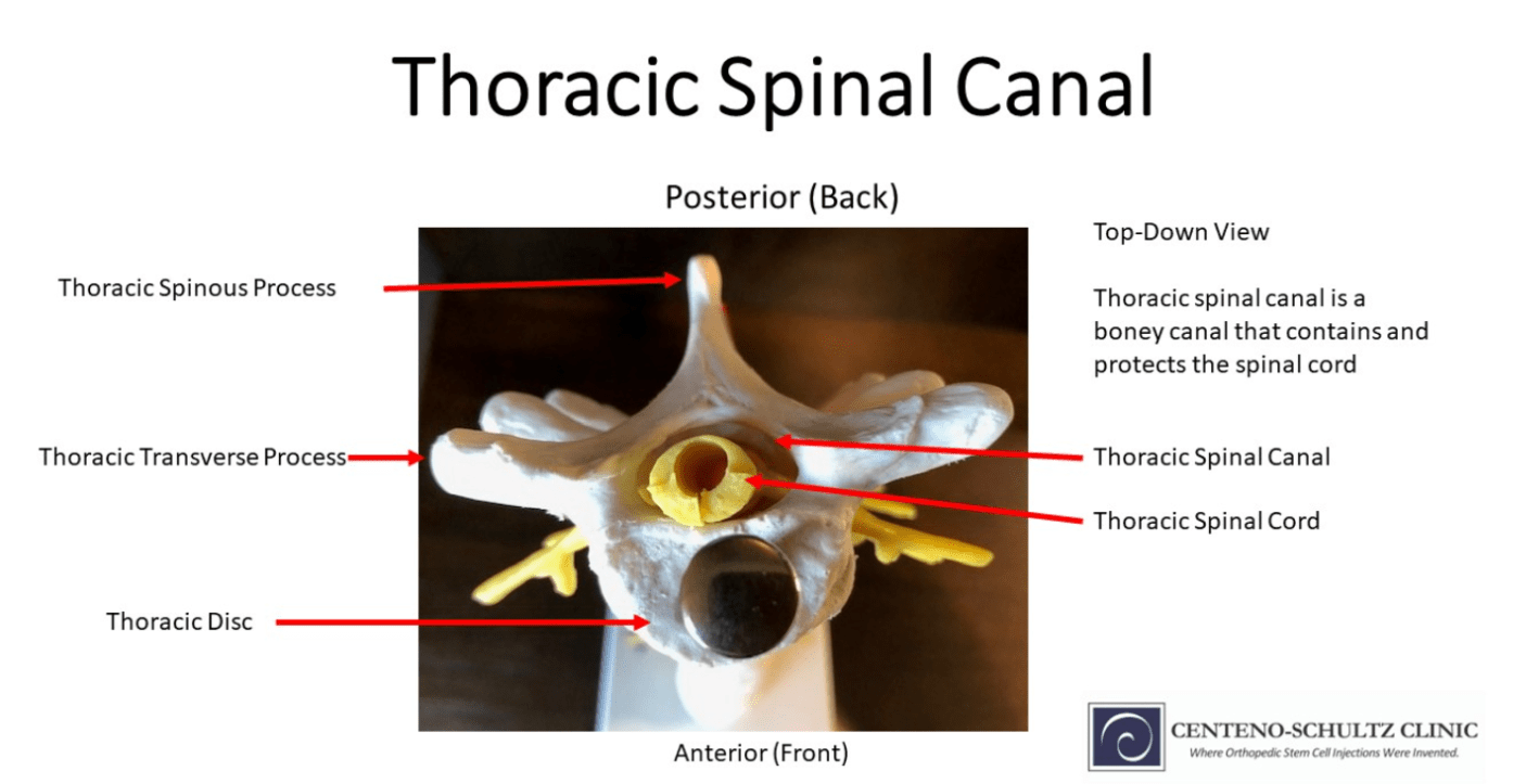 Where Is The Thoracic Spine? CentenoSchultz Clinic