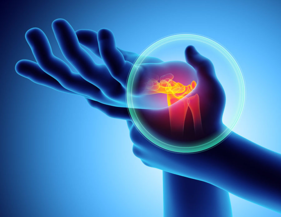 Ulnar Shortening Surgery What You Need to Know