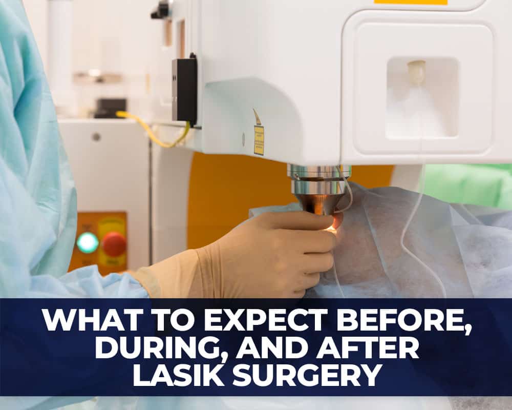 What to Expect Before, During, and After LASIK Eye Surgery Center for