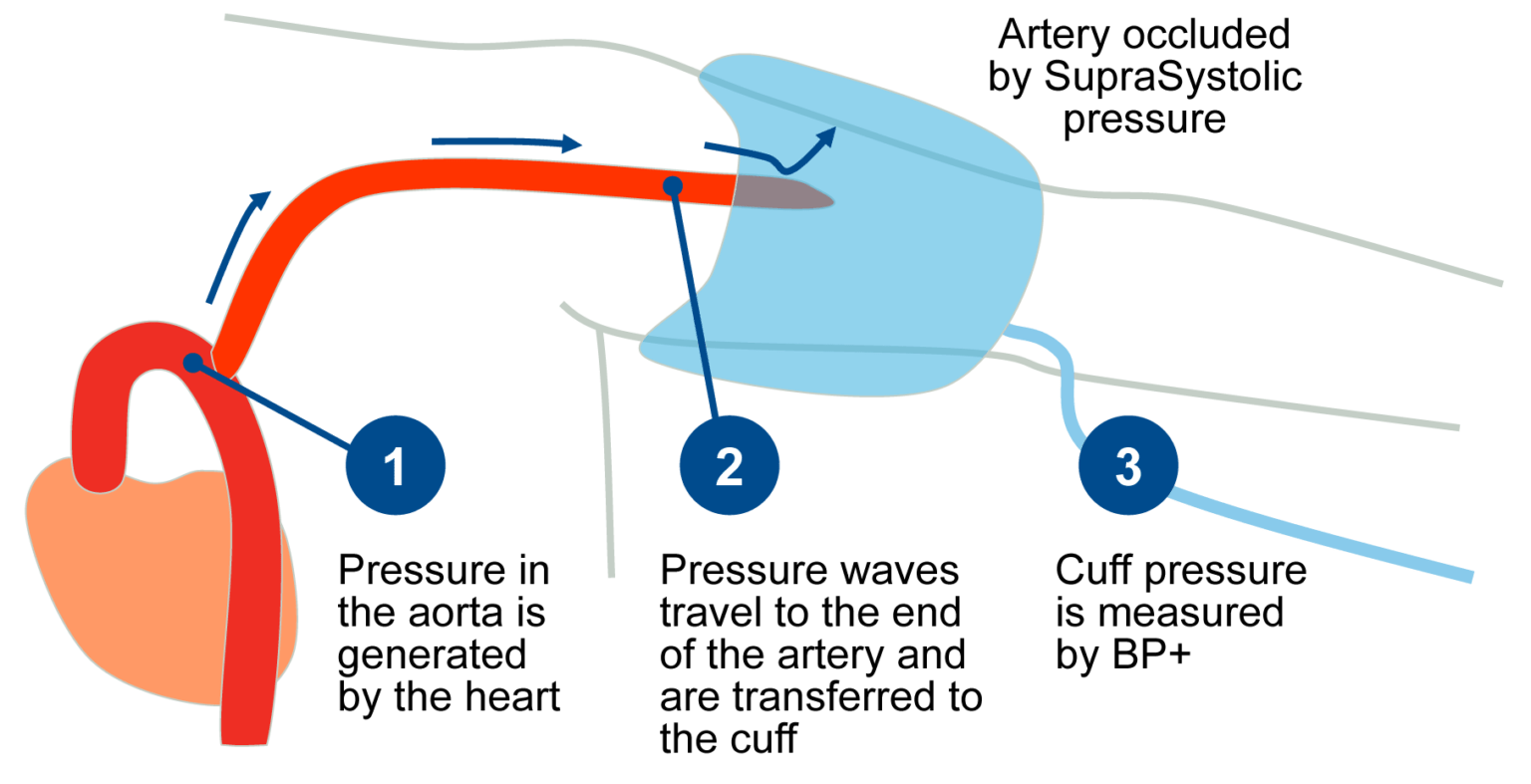 Non Invasive Central Blood Pressure Central Blood Pressure