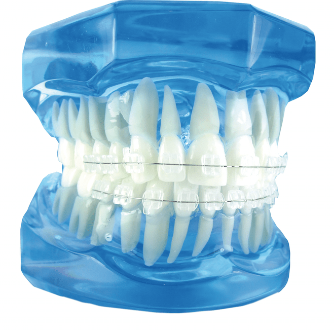 Bracket Estético de Zafiro Baja Fricción DISCREET PLUS, ADENTA