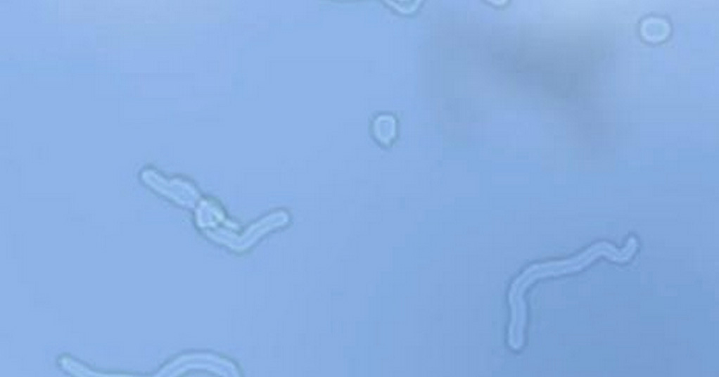 Floaters Central Florida Eye Center, P.A.