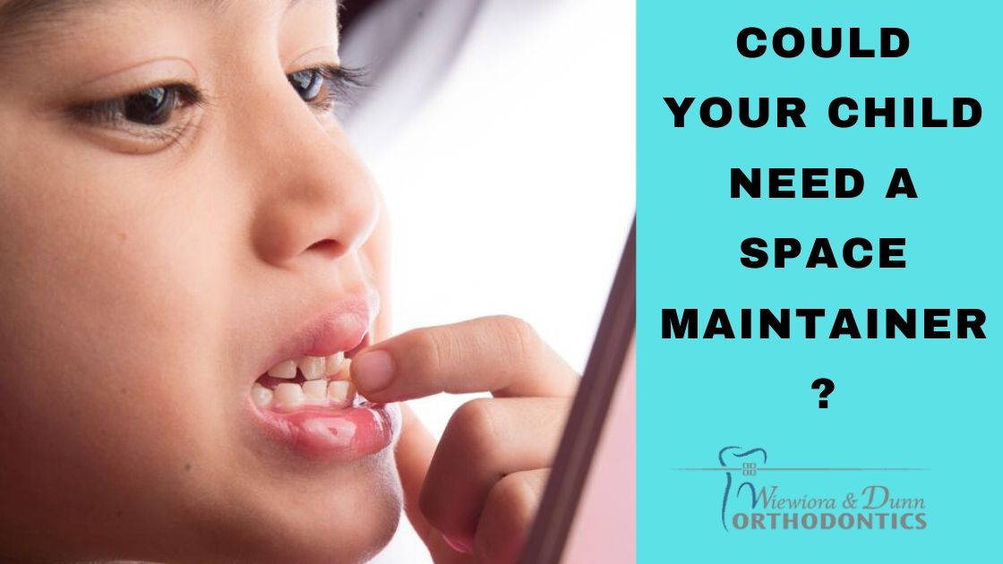 Does Your Child Need a Space Maintainer? Wiewiora & Dunn Ortho