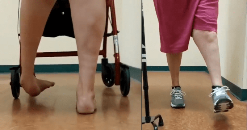 Complex Foot and Ankle Reconstructive Surgery at Certified Foot