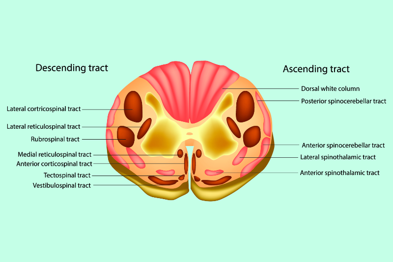 Tabes Dorsalis Spinal Cord
