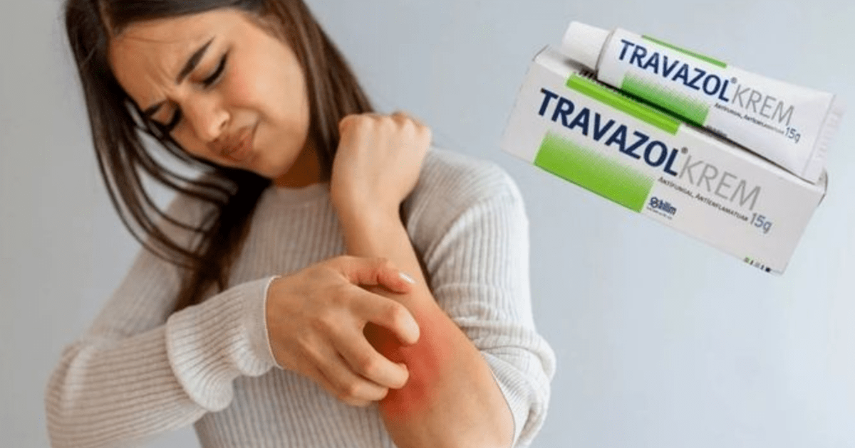 Travazol Krem Nedir? Ne İşe Yarar? KizlarSoruyor