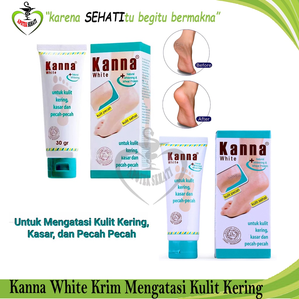 Jual Kanna White Cream untuk Kulit Kering Kasar dan Kaki PecahPecah