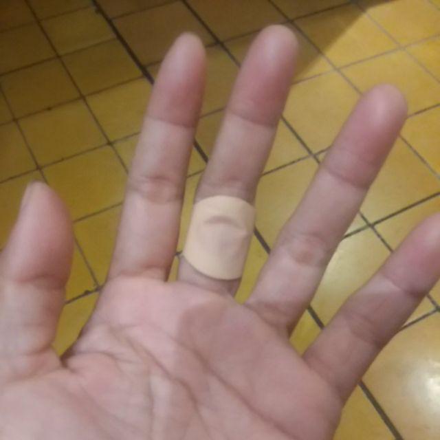 Cara Menghilangkan Kutil Di Telapak Tangan Menghilangkan Masalah