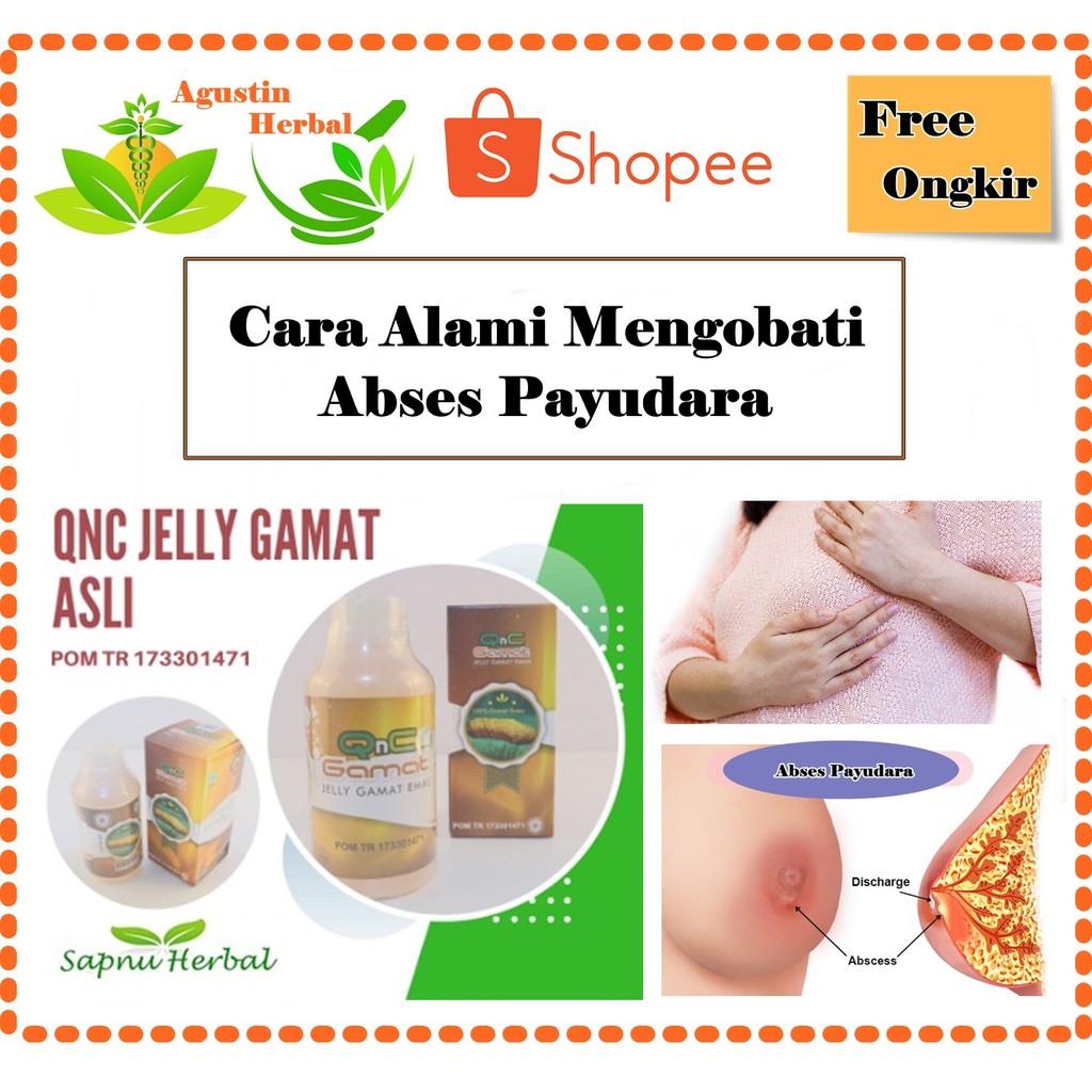 Obat Abses PayudaraAbses PayudaraObat Abses Payudara Ibu Menyusui