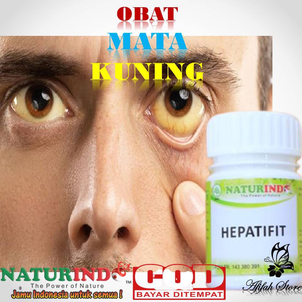 OBAT MATA KUNING AMPUH OBAT MATA MINUS KATARAK MATA PANDA MATA MERAH MATA  PANAS MATA RABUN HERBAL | Shopee Indonesia