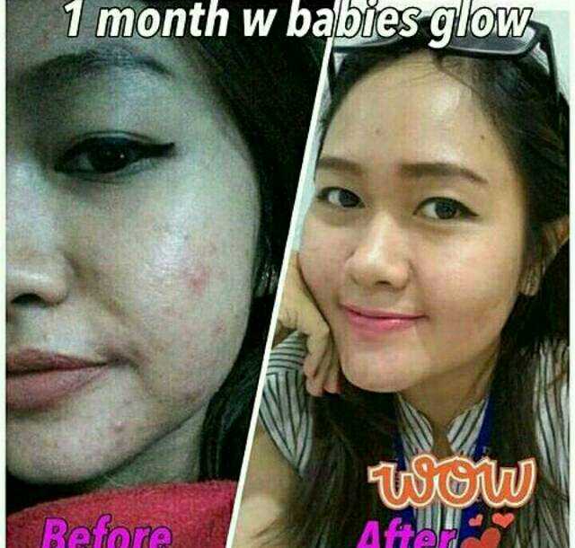 Babies Glow Aesthetic Clinic Jogja The Engineering Internship Cover Letter