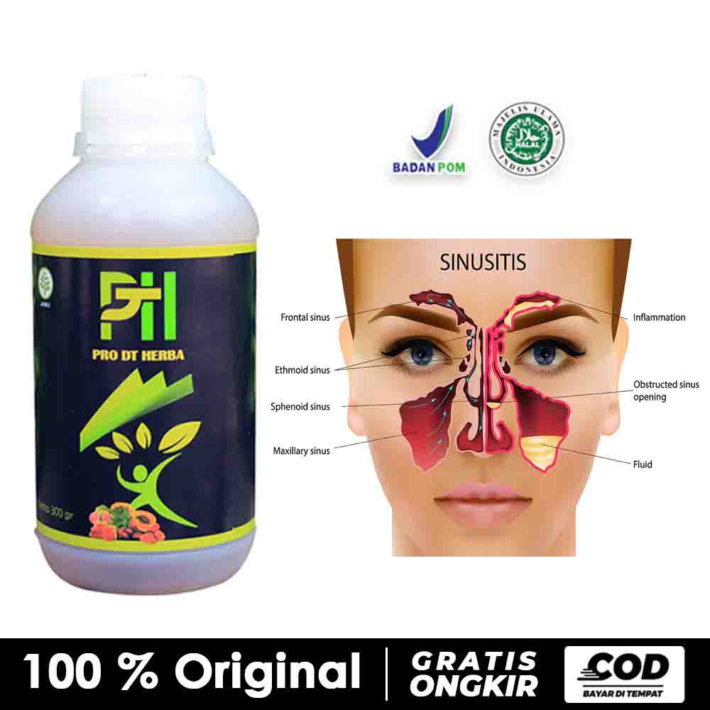 Jual Solusi Sinusitis Sembuh dengan Pro DT Herba Non Obat Sinusitis