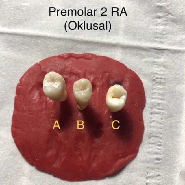 Jual JUAL GIGI PREMOLAR 2 RA( GIGI ASLI PRAKTIKUM) Shopee Indonesia