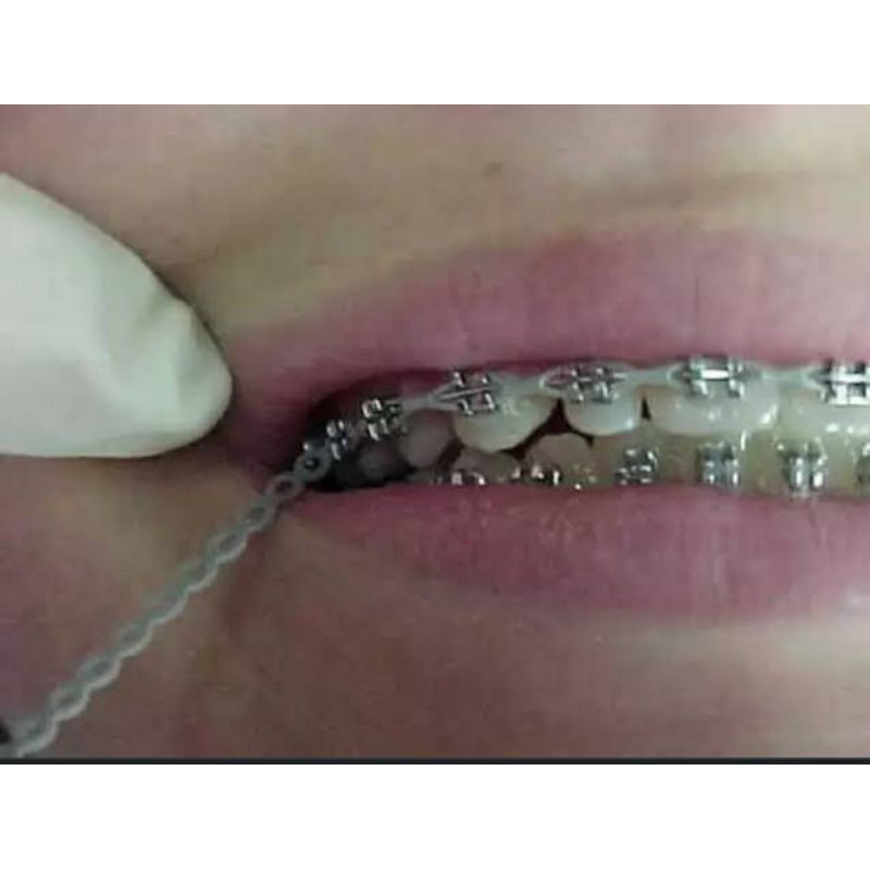 Jual Karet Behel panjang (POWER CHAIN SILVER GRAY) 9 cm/ 24 lubang