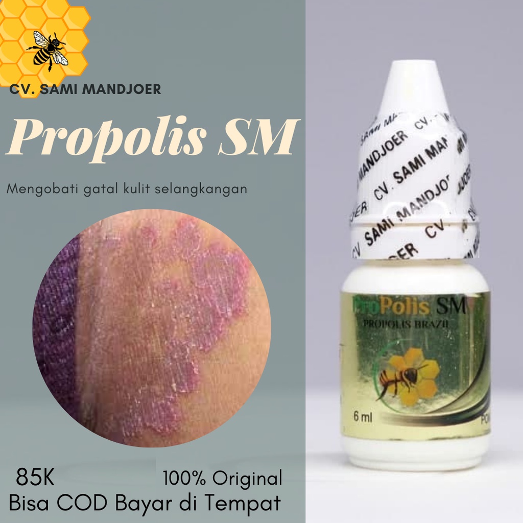 Jual obat gatal selangkangan eksim dan jamur, Obat Kurap Selangkangan, Salep gatal Selangkangan